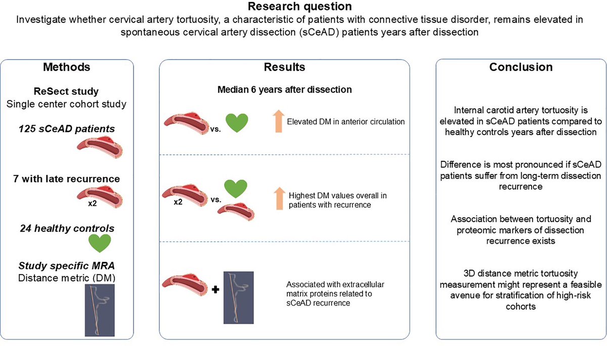 Cervical Artery Tortuosity Is Associated With Dissection Occurrence and Late Recurrence: A Nested Case-Control Study | Stroke ahajournals.org/doi/abs/10.116…