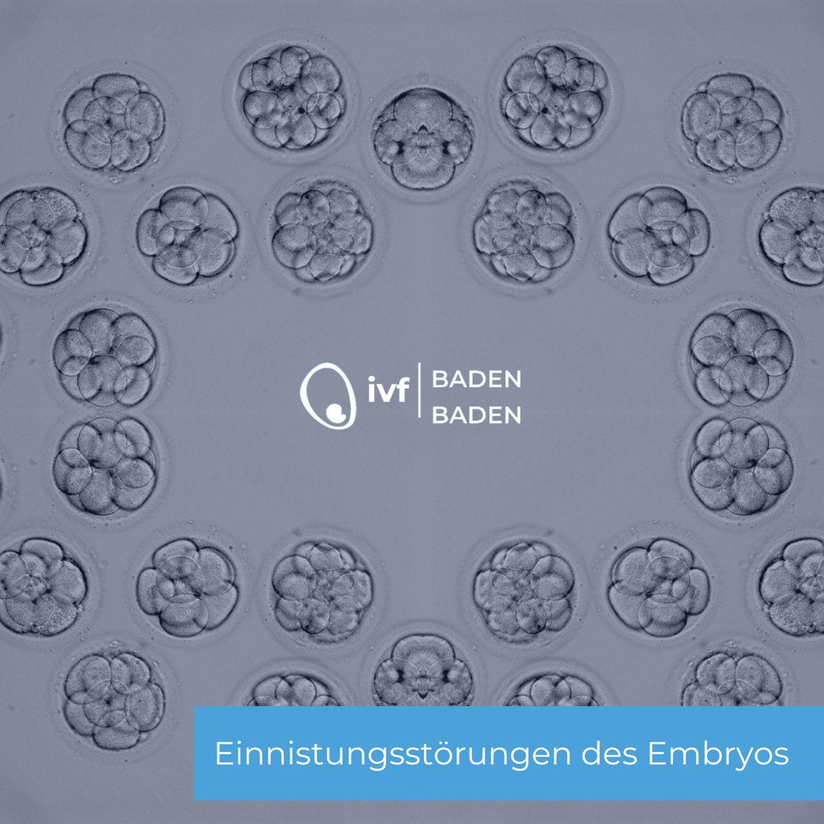 Hast du Probleme mit der Einnistung des Embryos? 😔💫

In unserem Blog erklären wir Ursachen &amp; Lösungen, inkl. Techniken wie ER Map &amp; IM Map, die deine Chancen auf eine erfolgreiche Einnistung erhöhen.

➡️ bit.ly/3CQkV4S