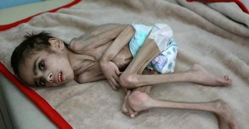 Your contribution can be the source  " Hope " For hungry families eating tree leaves. and Children  that in  are starving to the point where they are chewing on their own hands,mistaking them for food Please  Look what we do
sites.google.com/view/your-abil…
Donate 
paypal.me/yourab