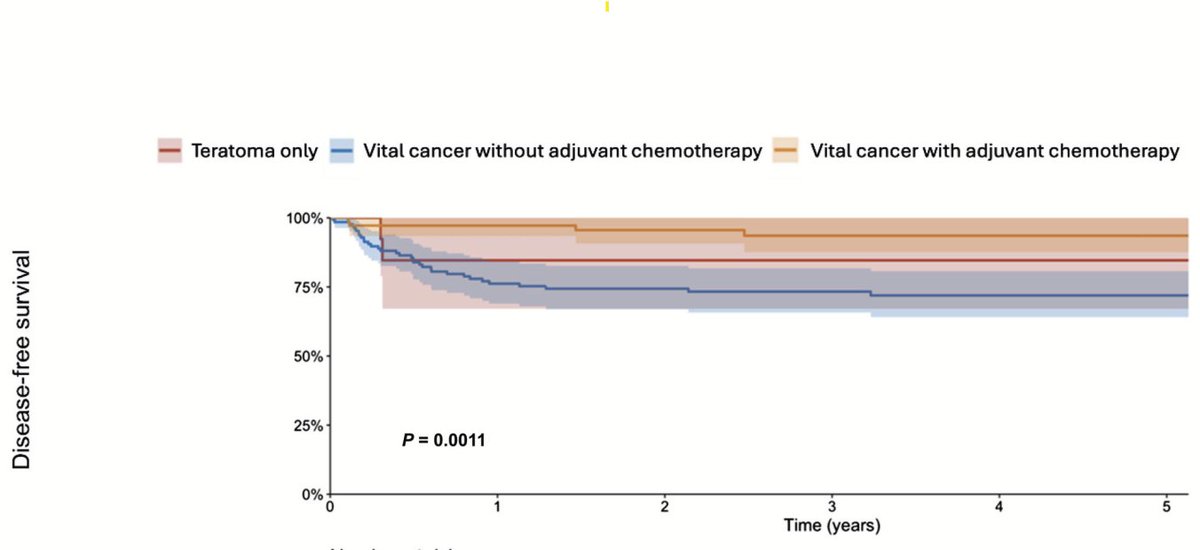 primary RPLND in CSIIa/b germ cell tumours+-adjuvant chemotherapy in &gt;300 men, largest cohort published
📊 1/3 had no cancer in removed nodes, cave overtreatment
🎯 Larger marker neg nodes predict teratoma, resection in selected 2b
💉 2 cycles adj chemo after surgery at max
