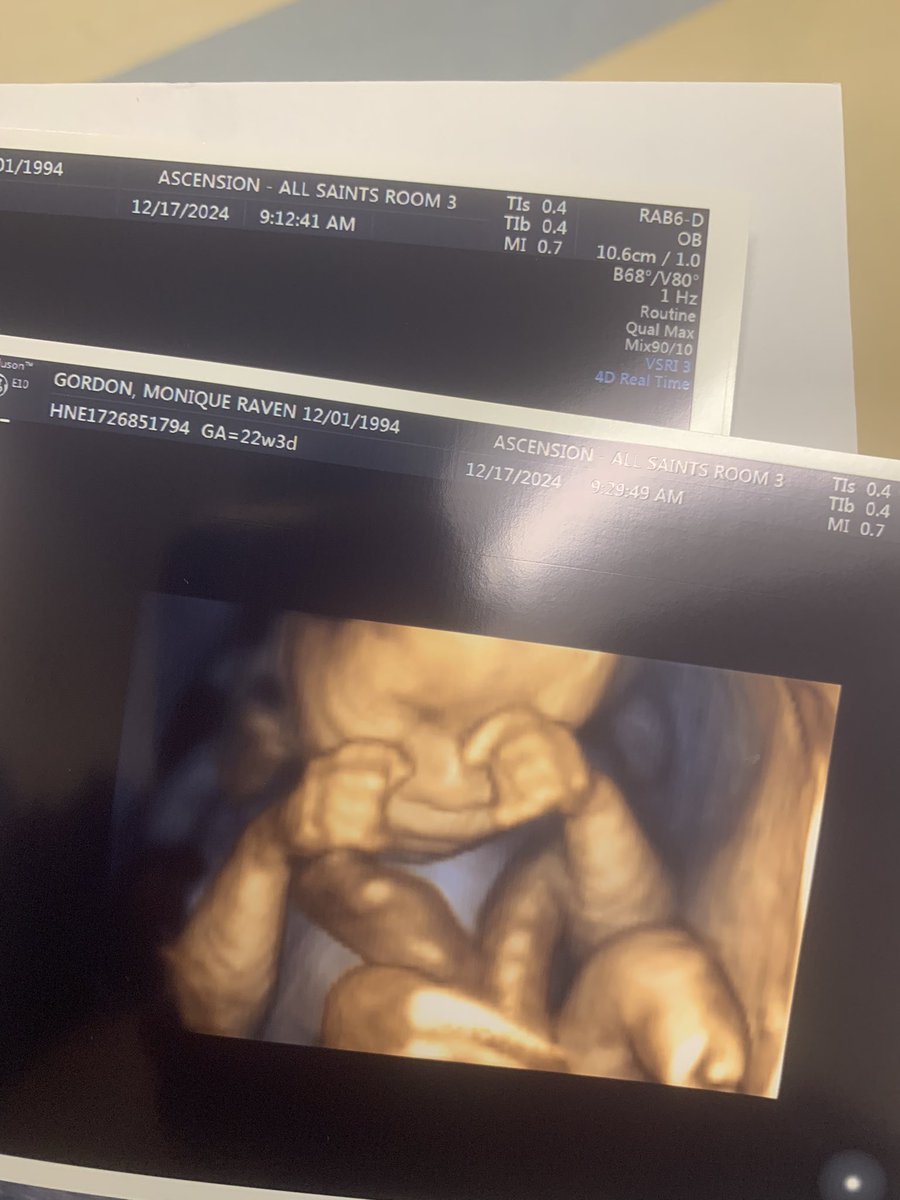 CharlieRudegal's tweet photo. I’ve been busy 😭❤️🚼 Baby K 🥹💞she’ll be here 4/19/2025#LLLiq🤍🤞🏽 https://t.co/Npk1MMx134