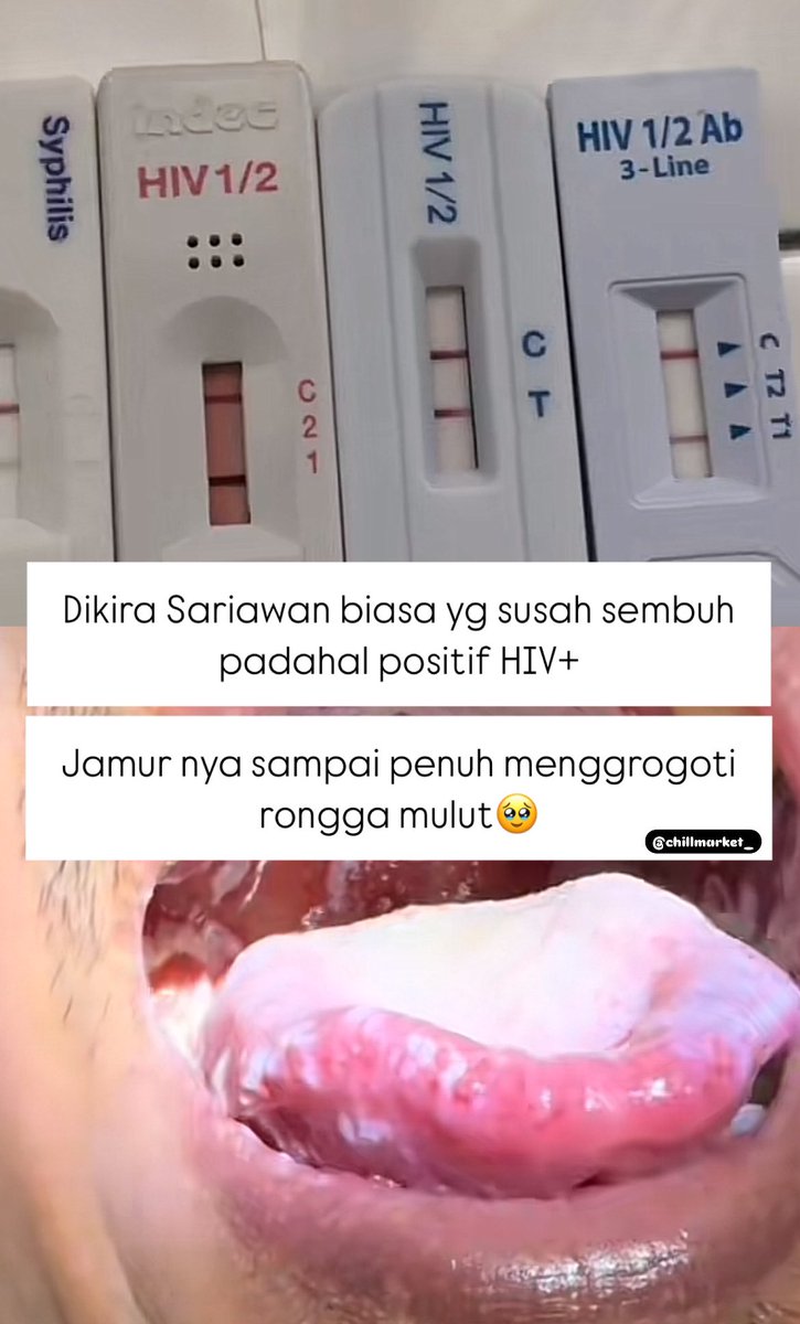 JiwaShine's tweet photo. Ayo yg sering jajan, hati-hati ‼️

— a thread https://t.co/hkNSewbVgs