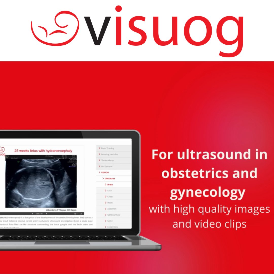ISUOG's tweet photo. VISUOG, ISUOG’s online visual encyclopedia, offers expertly curated, evidence-based information on the use of #ultrasound in obstetrics and gynecology.

Perfect for professionals and trainees, #VISUOG offers comprehensive chapters and high-quality visuals. 

Find out more here and become a member for full access: https://t.co/buT2ZijSwX #LoveUltrasound