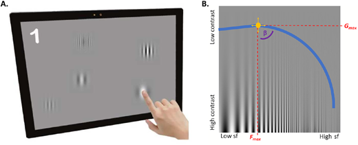 TVST Journal (@arvotvst) on Twitter photo @anacatalinarod7 <a href="/MariyaMoosajee/">Prof Mariya Moosajee</a> <a href="/UCLeye/">UCL Institute of Ophthalmology</a>: Assessing Contrast Sensitivity Function in CRB1-Retinopathies: Exploring Child-Friendly Measures of Visual Function doi.org/10.1167/tvst.1…
Adv in Cellular & Molecular Pathology of Inherited Retinal Degenerations bit.ly/3YrDQeO @anacatalinarod7 <a href="/MariyaMoosajee/">Prof Mariya Moosajee</a> <a href="/UCLeye/">UCL Institute of Ophthalmology</a>: Assessing Contrast Sensitivity Function in CRB1-Retinopathies: Exploring Child-Friendly Measures of Visual Function doi.org/10.1167/tvst.1…
Adv in Cellular & Molecular Pathology of Inherited Retinal Degenerations bit.ly/3YrDQeO