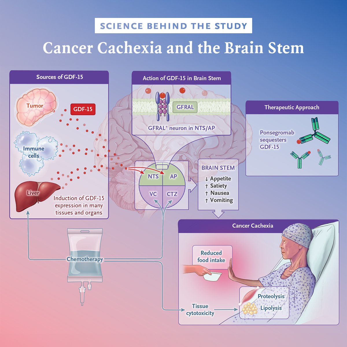 NEJM's tweet photo. Vickie E. Baracos, PhD, describes the science behind a study of ponsegromab to treat cancer cachexia. Ponsegromab suppresses a pathway in neurons located in specific regions of the brain stem. Read the full editorial: https://t.co/MQ3Qs6xrld https://t.co/FMOQuyFHaz