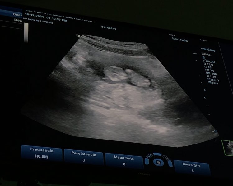 Nazareth_espi's tweet photo. No hay una felicidad más grande que tú llegarás a nuestras vidas🥹💙💖 
@juanleon2552 https://t.co/2UvsR4N7Vf
