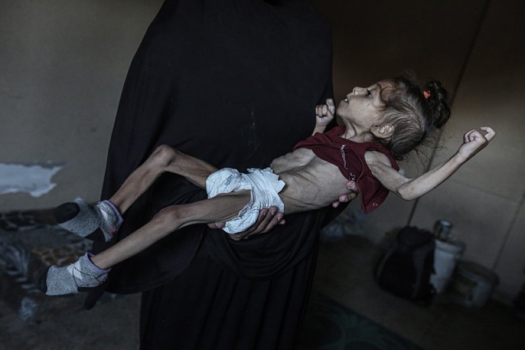 LOOK AT WHAT THEY ARE DOING TO CHILDREN