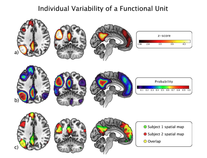 Addressing Inconsistency in Functional Neuroimaging: A Replicable Data-Driven Multi-Scale Functional Atlas for Canonical Brain Networks | bioRxiv biorxiv.org/content/10.110…