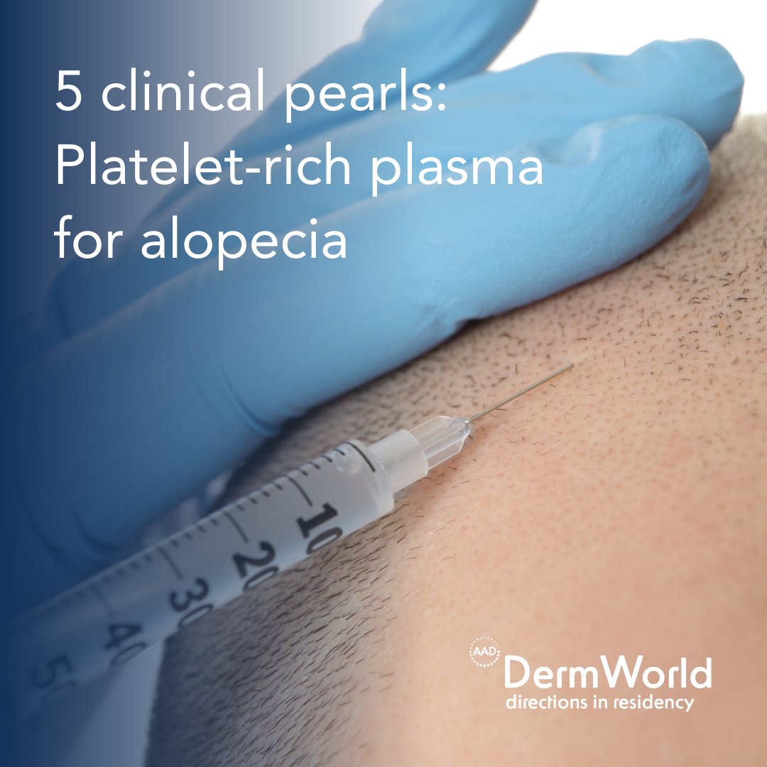 AADmember (@aadmember) on Twitter photo Board-certified #dermatologist <a href="/drrondafarah/">Ronda Farah MD She/her/hers</a> and hair loss research fellow Kim T. Nguyen, BS, provide five clinical pearls for treating #alopecia with platelet-rich plasma in the AAD's #DermWorld Directions in Residency. aad.org/member/publica… Board-certified #dermatologist <a href="/drrondafarah/">Ronda Farah MD She/her/hers</a> and hair loss research fellow Kim T. Nguyen, BS, provide five clinical pearls for treating #alopecia with platelet-rich plasma in the AAD's #DermWorld Directions in Residency. aad.org/member/publica…