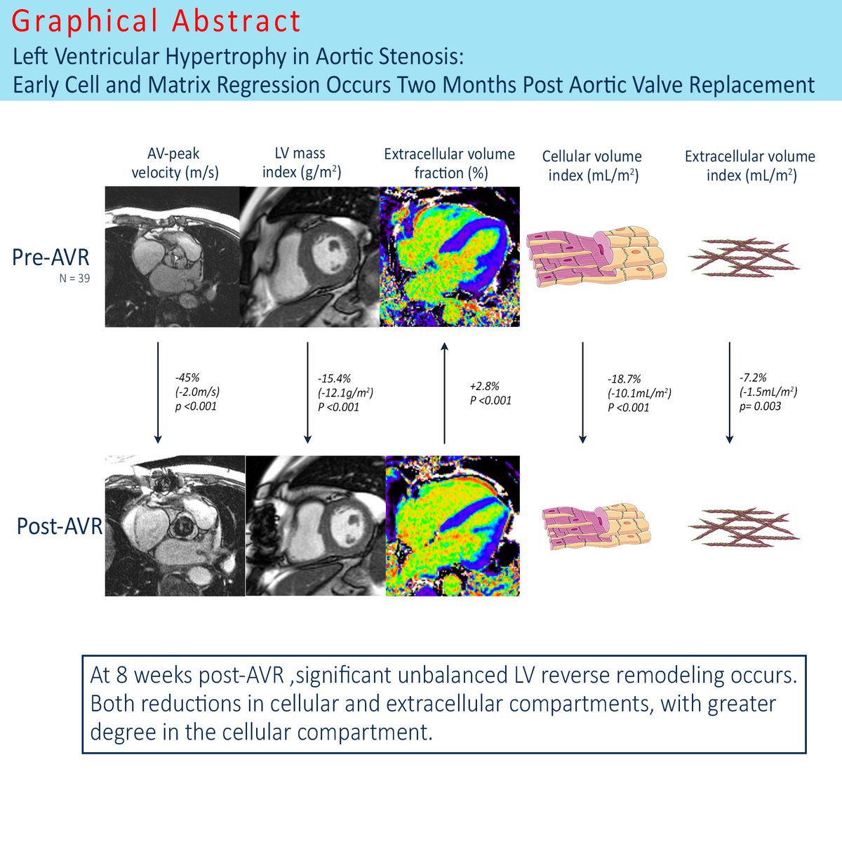 CircImaging (@circimaging) on Twitter photo Do you know the reduction of LV mass after AVR will be driven by "cellular compartment regression" or "extracellular regression"?
Check out the new article in <a href="/CircImaging/">CircImaging</a> below!
#AHAJournals <a href="/JiwonKimMD/">Jiwon Kim, MD</a> <a href="/kaznegishi/">Kaz Negishi@Cardiologist/ Heart Mafia</a>
ahajrnls.org/3BGPPfD Do you know the reduction of LV mass after AVR will be driven by "cellular compartment regression" or "extracellular regression"?
Check out the new article in <a href="/CircImaging/">CircImaging</a> below!
#AHAJournals <a href="/JiwonKimMD/">Jiwon Kim, MD</a> <a href="/kaznegishi/">Kaz Negishi@Cardiologist/ Heart Mafia</a>
ahajrnls.org/3BGPPfD