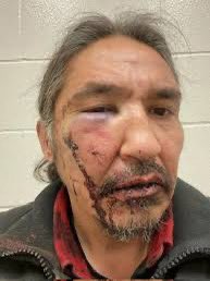 If the RCMP can do this to a First Nation’s chief and get away with it, imagine what they can do to any Indigenous person.

theglobeandmail.com/canada/alberta…