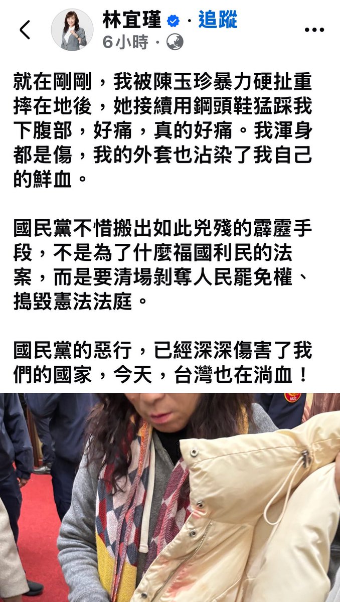loveagrogirl's tweet photo. 陳玉珍穿著鋼頭鞋 故意弄摔好幾個女立委再狂踹狂踩 見血為止 意圖致人於死地 https://t.co/TKtV0vqrp7