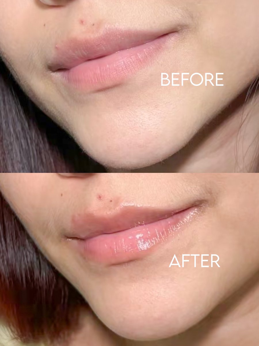 beautyayyy's tweet photo. gusyy liat!!! ada gebrakan baru dari elformula yg bikin lip treatment di akhir tahun ini💋

dari pertama kali coba udh tau bakalan suka krn bikin bibir juicy, lembab &amp; shiny✨ https://t.co/akgbRSlSmR