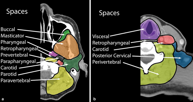 I am reading thieme-connect.com/products/ejour…

#irad #radtwitter #radiology #MedTwitter