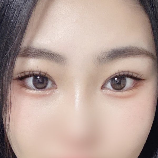 みょん👀韓国目の整形DTレポ垢 tweet media