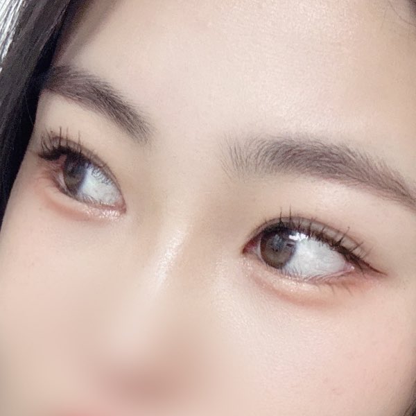 みょん👀韓国目の整形DTレポ垢 tweet media