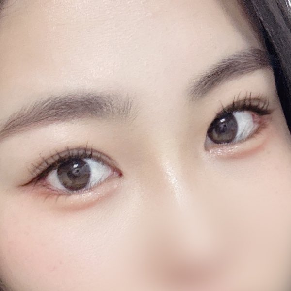 みょん👀韓国目の整形DTレポ垢 tweet media