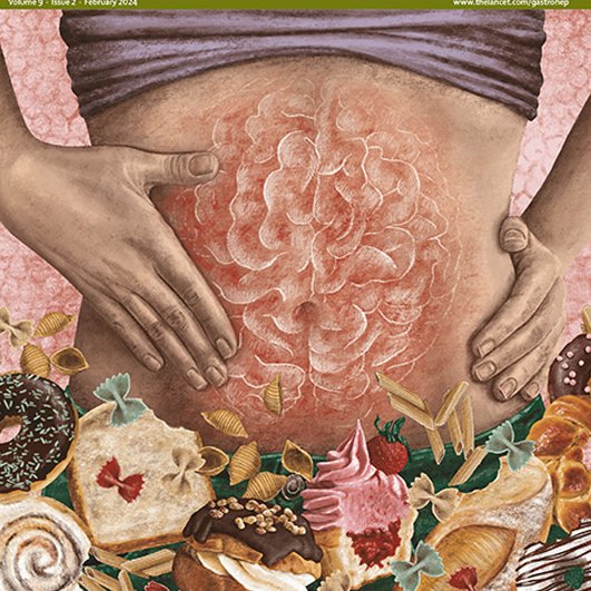 The Lancet Gastroenterology & Hepatology (@lancetgastrohep) on Twitter photo How much of a role does expectancy of gluten intake have in symptoms of non-coeliac gluten sensitivity? An RCT probed the role of the nocebo effect in this condition - thelancet.com/journals/langa…
#GITwitter <a href="/louisedye/">louise dye</a> How much of a role does expectancy of gluten intake have in symptoms of non-coeliac gluten sensitivity? An RCT probed the role of the nocebo effect in this condition - thelancet.com/journals/langa…
#GITwitter <a href="/louisedye/">louise dye</a>