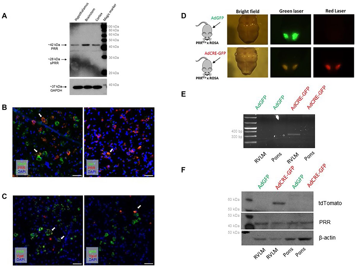 Function (@aps_function) on Twitter photo 🩺🫀Does biological sex play a role in #hypertension? This study illustrates the complex & sex-dependent role of PRR in the neural control of #BloodPressure & hydromineral balance through autonomic and neuroendocrine systems.
ow.ly/GXaY50UuzlQ
<a href="/MedicalCollege/">Medical College of Wisconsin</a> 🩺🫀Does biological sex play a role in #hypertension? This study illustrates the complex & sex-dependent role of PRR in the neural control of #BloodPressure & hydromineral balance through autonomic and neuroendocrine systems.
ow.ly/GXaY50UuzlQ
<a href="/MedicalCollege/">Medical College of Wisconsin</a>