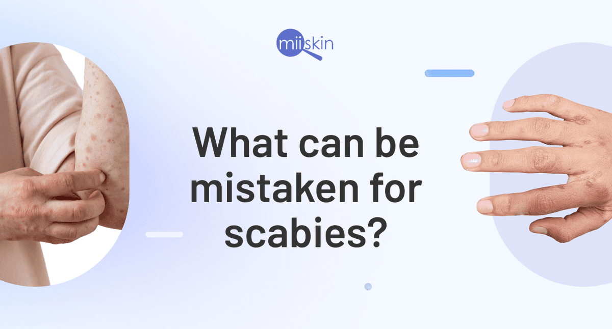 Online dermatologists and prescriptions | Miiskin tweet media