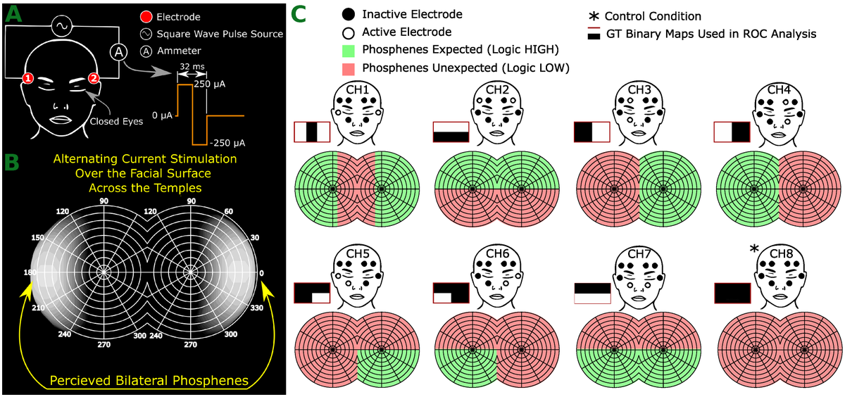 Sensors_MDPI's tweet photo. A Phosphenotron Device for Sensoric Spatial Resolution of Phosphenes within the Visual Field Using Non-Invasive Transcranial Alternating Current Stimulation 
https://t.co/fqh65gsVhH
@TorontoMet 
#phosphenes; #electricalstimulation; #visualprosthesis https://t.co/zybnvd8TdJ