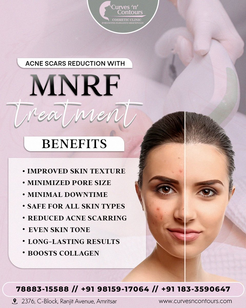 Say goodbye to acne scars! ✨ With MNRF treatment, enjoy improved skin texture, minimized pores, and a clearer, more even skin tone. Safe for all skin types with minimal downtime. 🌟

Call us: 78883-15588 | +9198159-17064 | +91183-3590647

 #MNRFTreatment #ClearSkinJourney