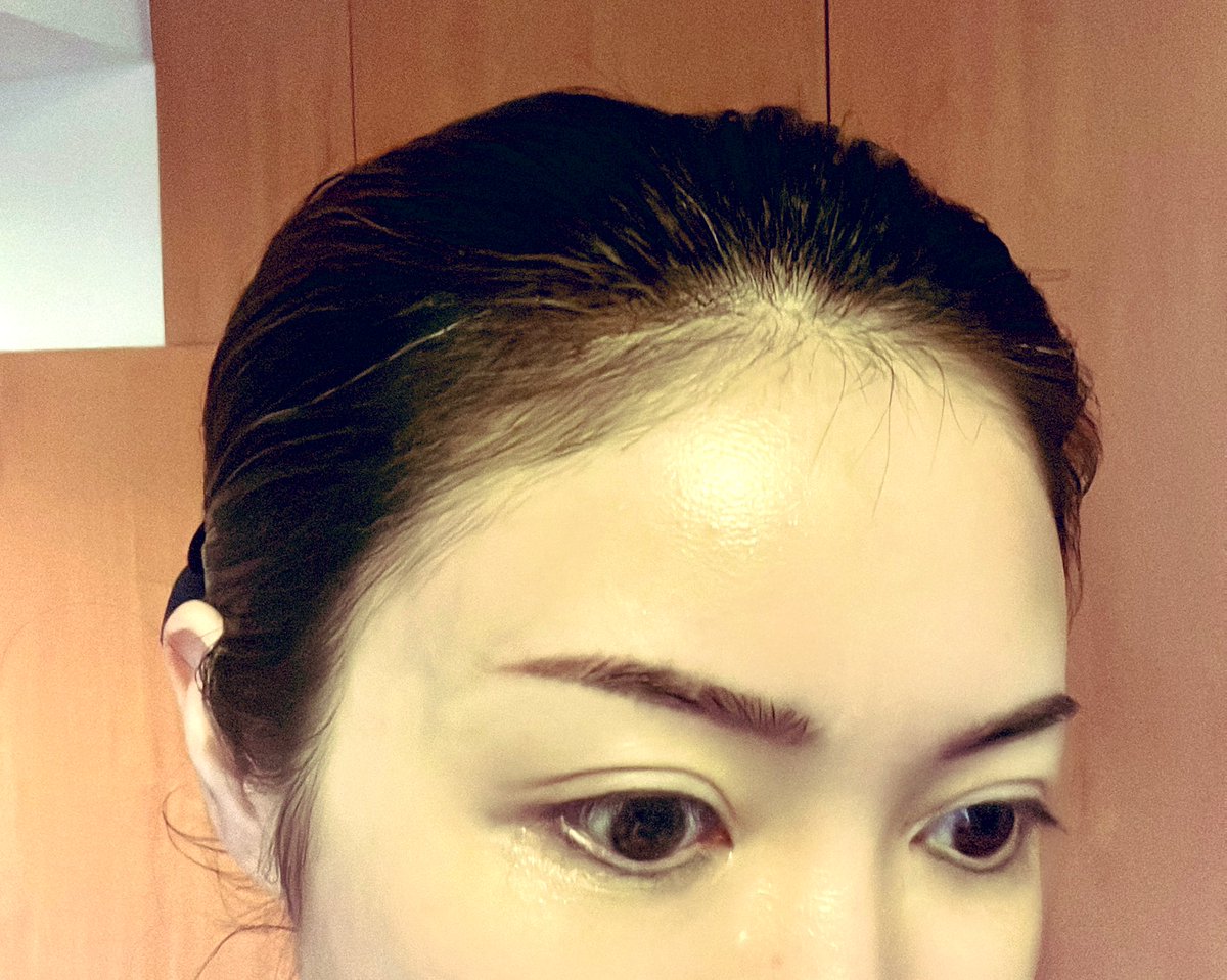 あちゃ(整形垢) (@MNcK4pjVAP7862) / Posts / X