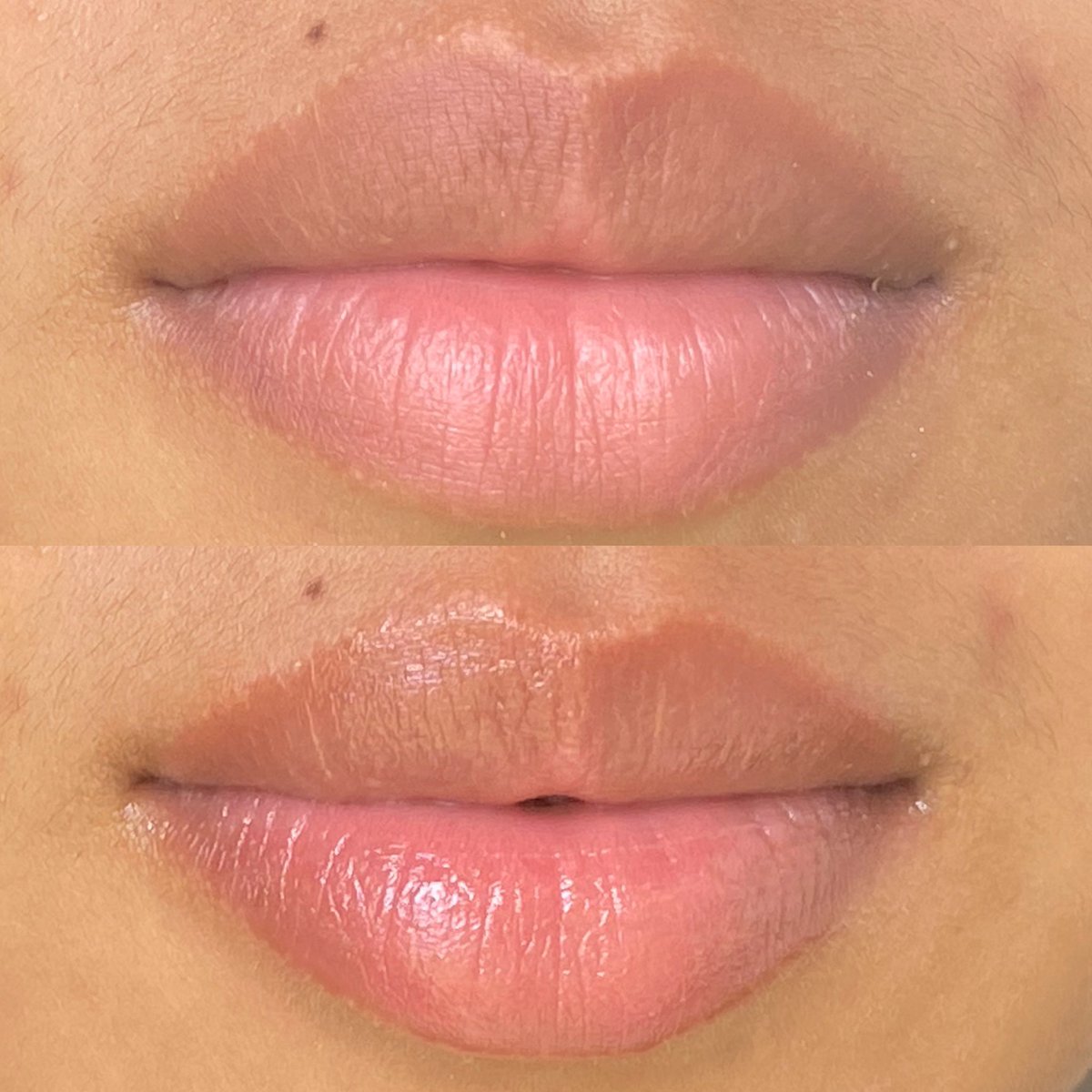 udah cobain banyak lip balm, tapi akhirnya ketemu yang GAME CHANGER banget buat bibir‼️🥹💗