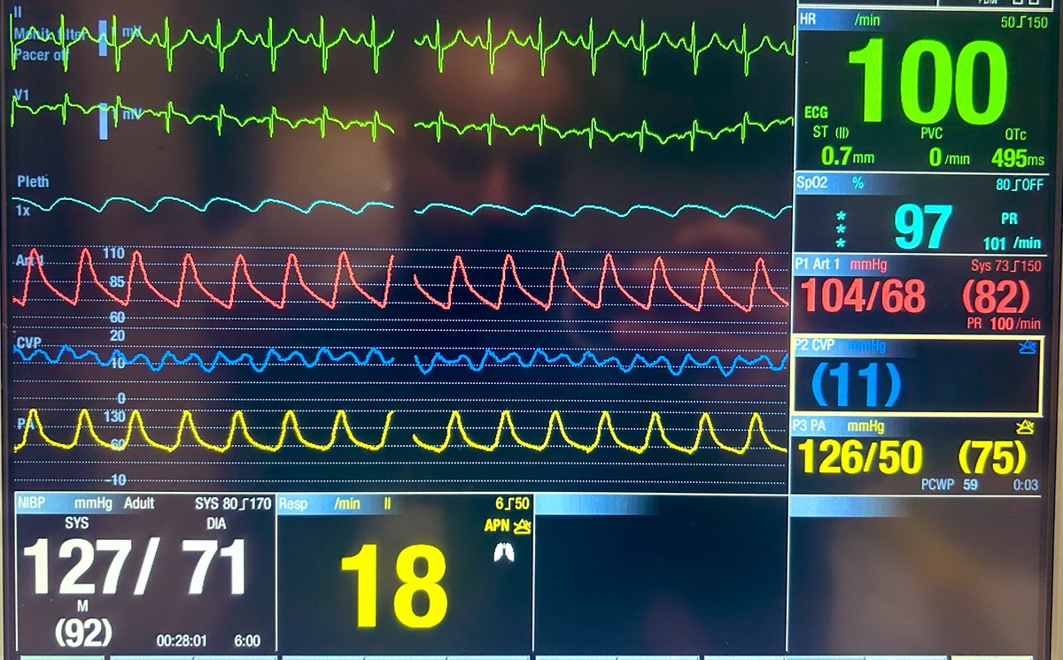 🤯 What comes to mind when you gaze at these waves on the monitor? Believe it or not, this is all very real! Allow me to take you on a journey through this fascinating story!
