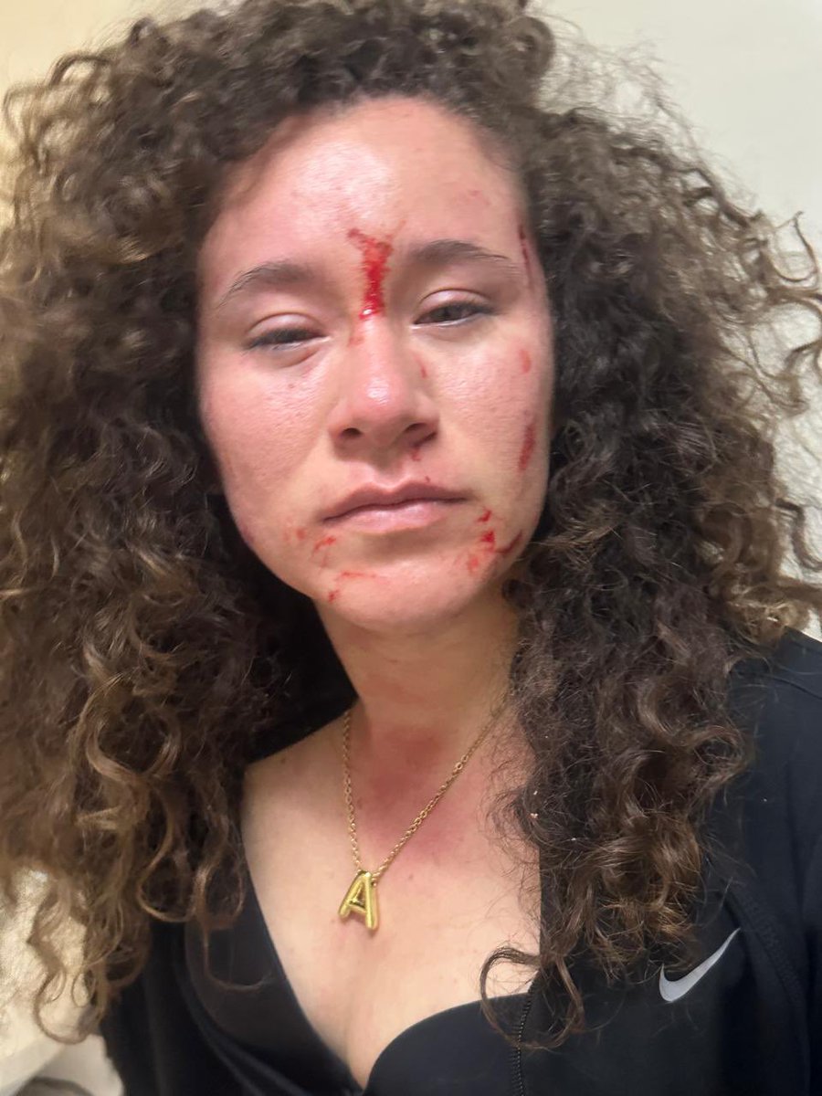 rioaxaca's tweet photo. #Oaxaca ¿ Hasta cuándo las autoridades seguirán sometidas a los arranques de ira y agresiones de la saxofonista mixteca María Elena Ríos (@_ElenaRios ) en su violento reclamo de justicia?

¿ Por qué permitir que en su reclamo agreda a otra mujer cuando Elena Ríos se asume como defensora de los derechos de las mujeres?

¿ Seguirá la @FISCALIA_GobOax protegiendo este actuar con elementos de la @AEI_Oaxaca como damas de compañía ?

¿ Cómo calificaría Elena Ríos el hecho de arrancar hasta una prenda íntima a otra mujer en medio de la riña?

Que hablen los hechos.