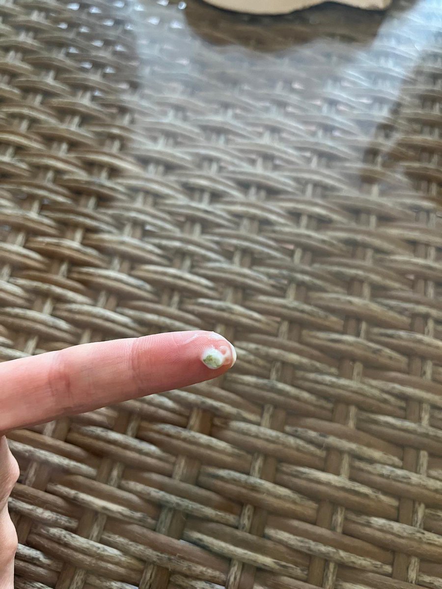 aabolopz's tweet photo. ���Alerta 🚨 
Estaba dándole a mi sobrino un Actimel Kids de merendar cuando me he dado cuenta de que tenía algo extraño al abrir, lo he palpado y parece una pequeña piedra. Al vaciar el contenido he reparado en que no era la única, en el fondo pueden verse hasta 2 más @danone_es https://t.co/0on5LmIeUK