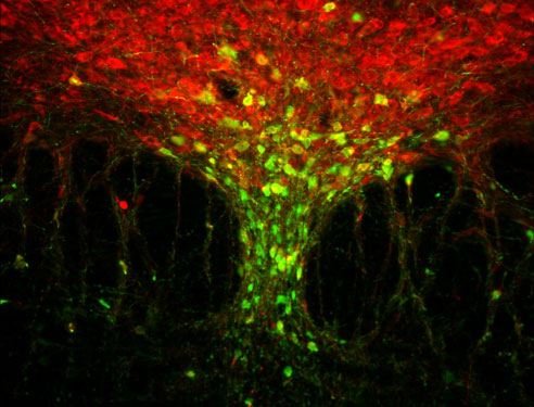 antibodiesinc's tweet image. The image below features green GFP (a great way to light up your research) and red Tryptophan Hydroxylase-positive neurons— bringing a festive touch to your work this holiday season!🎄✨
Check out our Anti-GFP Antibody: hubs.ly/Q030lTjh0