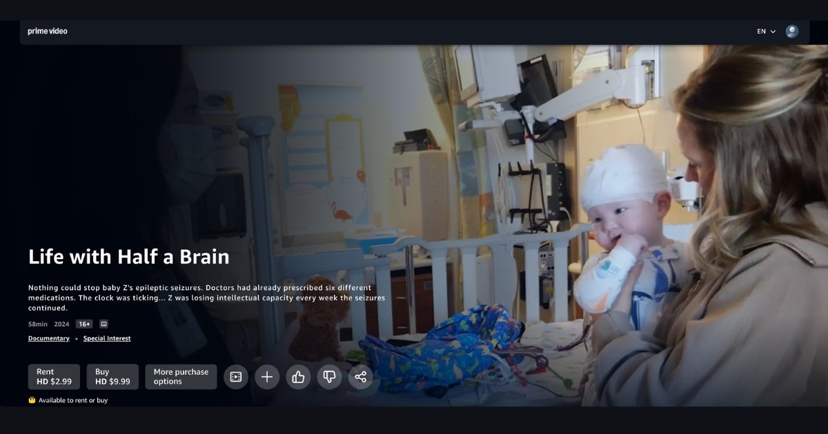 PESAlliance's tweet image. Grateful for this new doc about hemispherectomy Life With Half A Brain! TY @kobre for trusting us w helping source the interviews w our founder @MonikaJonesJD @Lurieneurosurg's @sandi_lam @ClevelandClinic's W Bingaman and @NeurosurgUCSF's K Auguste.
🎥 bit.ly/4fliZP9