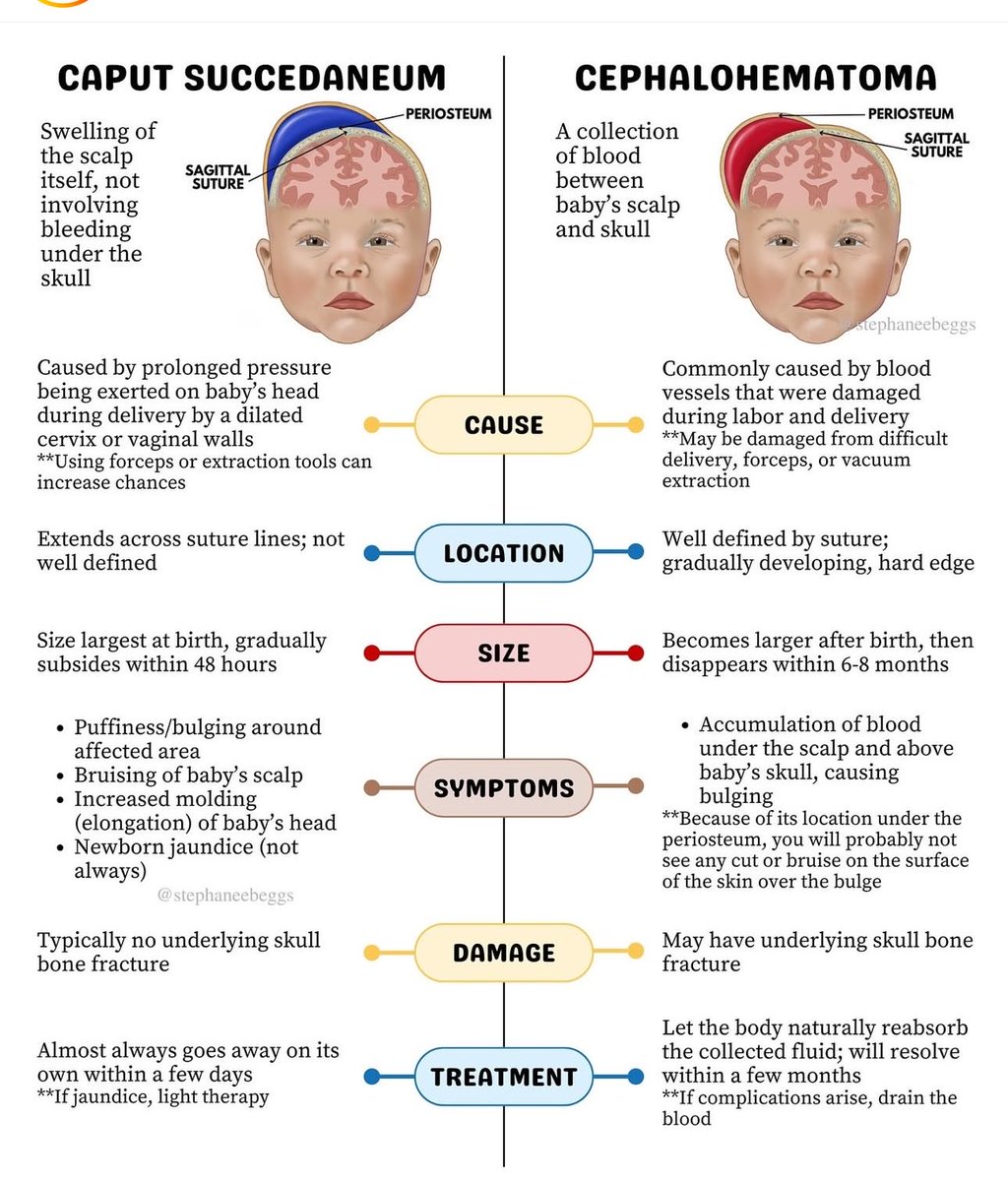 OGdukeneurosurg's tweet photo. Know the difference between these 2 scalp bleeds https://t.co/bzUwjFUylg