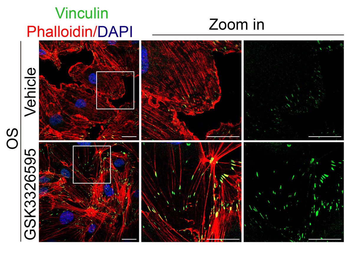 CircRes's tweet image. Ma et al found that mechanical forces lead to #arginine #methylation of #Kindlin-2, which influences vascular stability through its role in #LLPS. Learn more about a potential strategy for treating vascular disorders &amp;amp; #atherosclerosis at ahajrnls.org/4fpl7FP