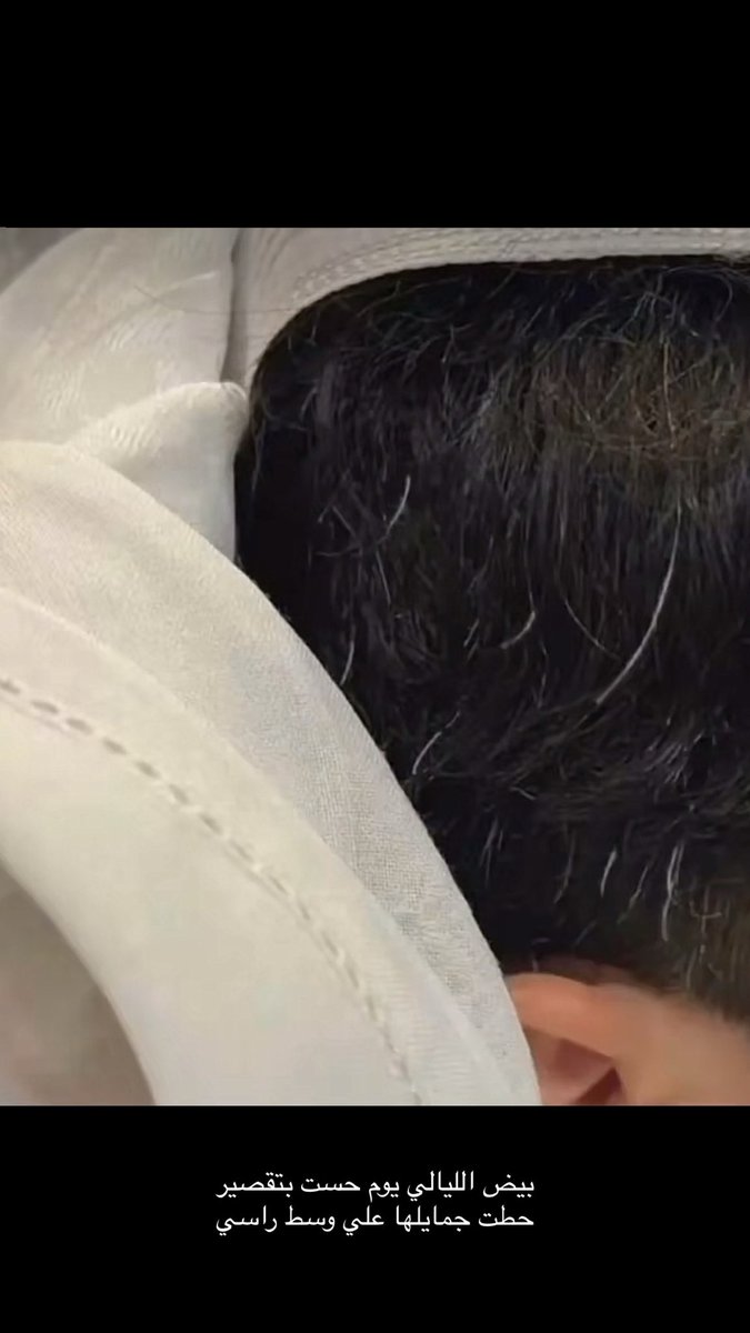بيض الليالي يوم حست بتقصير 
حطت جمايلها علي وسط راسي
