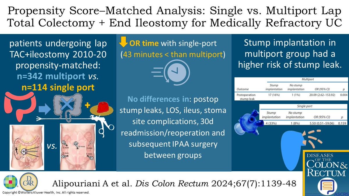DCRjournal (@dcrjournal) on Twitter photo #DCRJournal visual abstract | A Propensity Score–Matched Analysis of Single-Port Vs Multiport Laparoscopic Total Abdominal Colectomy With End Ileostomy for Medically Refractory Ulcerative Colitis: bit.ly/3Xdldu1
<a href="/drjamestaylor/">James Taylor</a> <a href="/KarasJoshua/">Joshua R Karas MD</a> <a href="/MaloneyNell/">Nell Maloney Patel</a> <a href="/Averywalker21/">Avery Walker, MD, FACS, FASCRS</a> #DCRJournal visual abstract | A Propensity Score–Matched Analysis of Single-Port Vs Multiport Laparoscopic Total Abdominal Colectomy With End Ileostomy for Medically Refractory Ulcerative Colitis: bit.ly/3Xdldu1
<a href="/drjamestaylor/">James Taylor</a> <a href="/KarasJoshua/">Joshua R Karas MD</a> <a href="/MaloneyNell/">Nell Maloney Patel</a> <a href="/Averywalker21/">Avery Walker, MD, FACS, FASCRS</a>