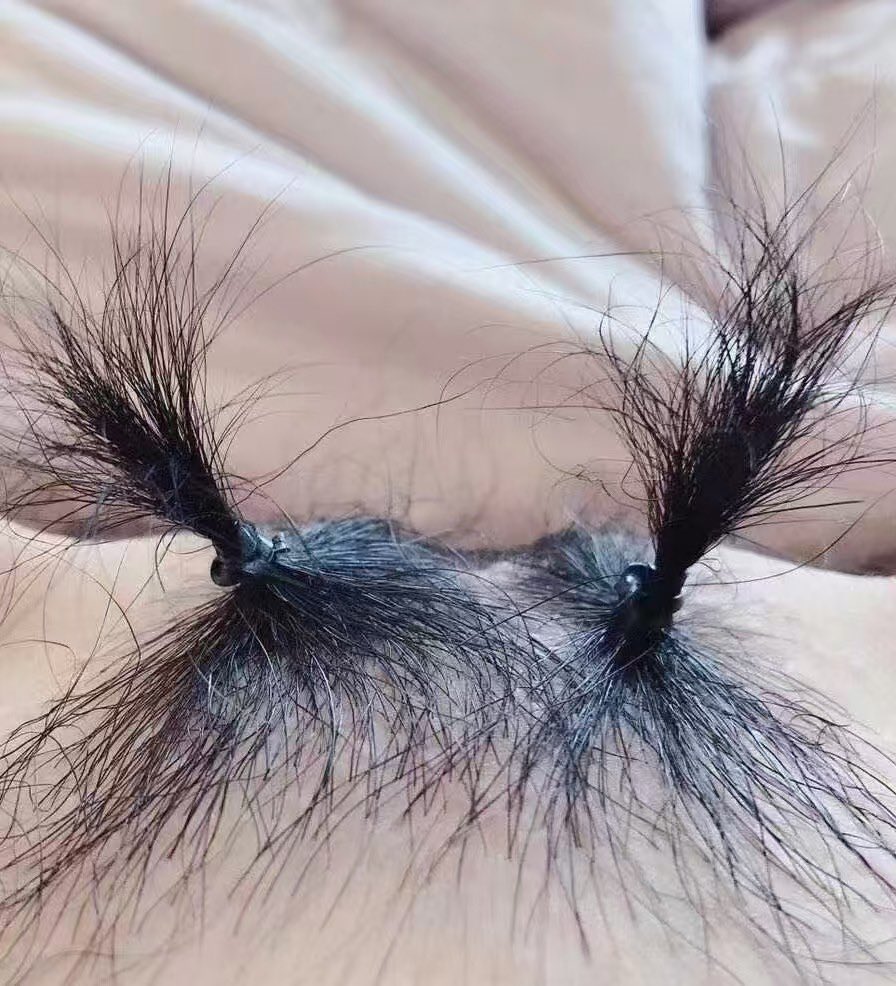 媒体预览