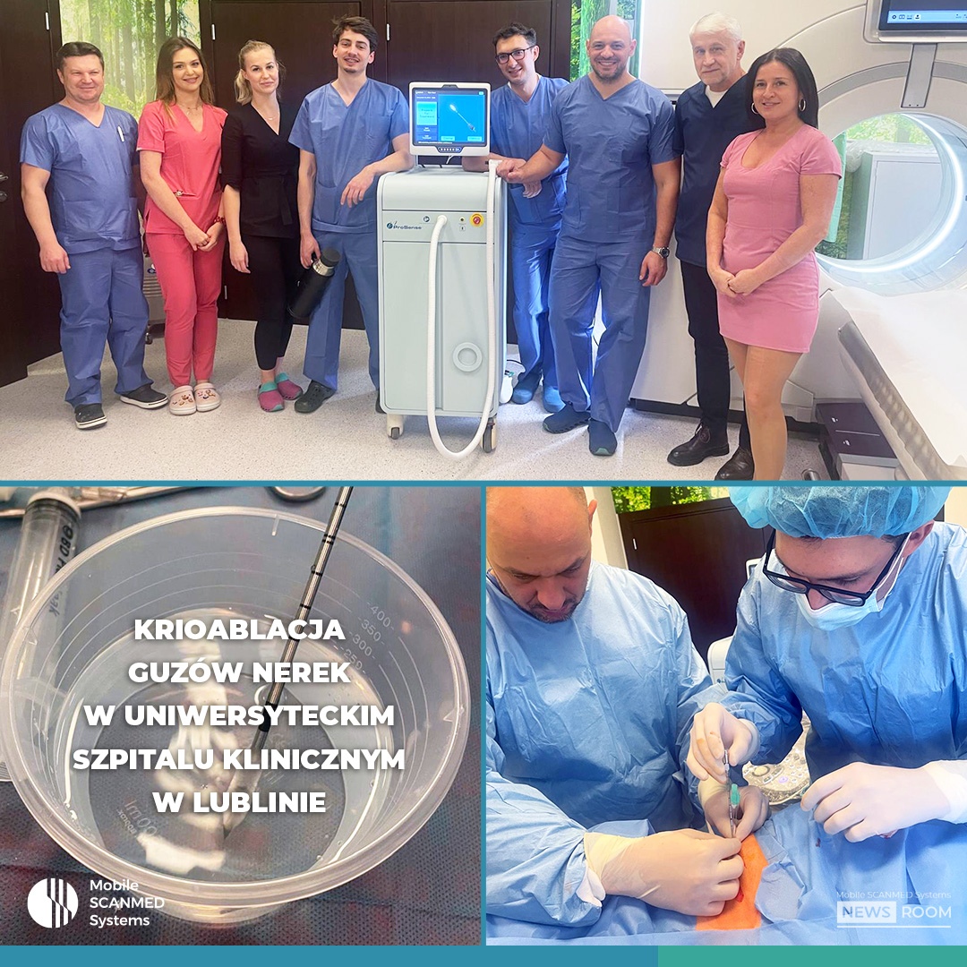 MobileScanmed's tweet photo. Lekarze z Uniwersyteckiego Szpitala Klinicznego nr 4 w Lublinie, dr Paweł Buraczyński - urolog oraz dr n med Łukasz Światłowski - radiolog przeprowadzili udane zabiegi przezskórnej #krioablacja guzów nerki. https://t.co/za1N7qZGRB