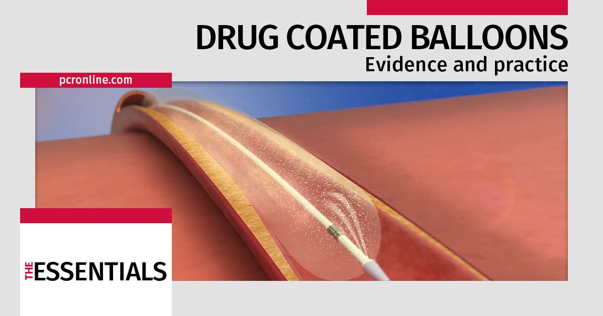 Over the years,  Drug-Coated Balloons 🎈 (DCBs) have undergone extensive development to meet the challenges of minimizing restenosis and maintaining vessel patency. 

With this new special report on The Essentials of DCB, led by <a href="/baumbach_a/">ABaumbach</a> ,  we aim to enhance understanding of