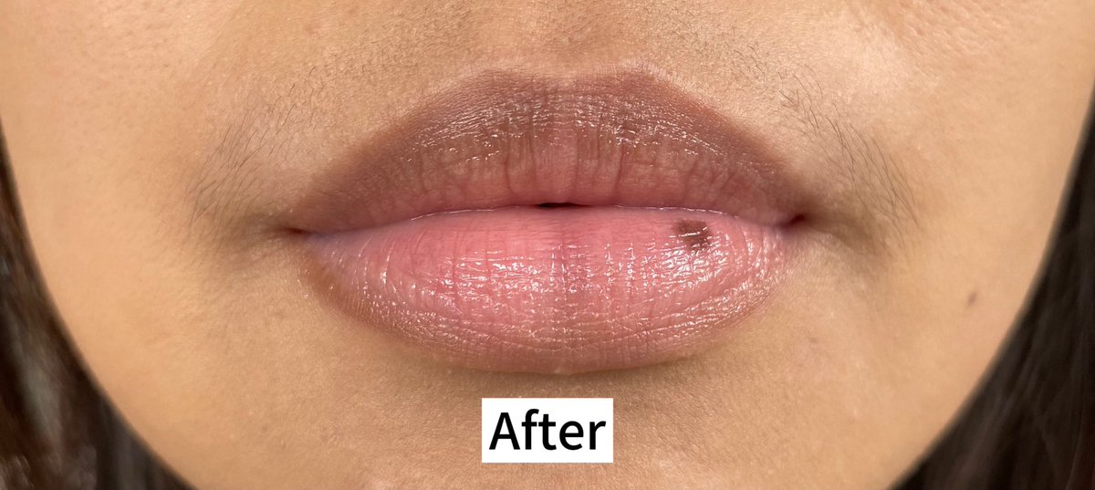 flweryull's tweet photo. Say bye-bye to bibir kering &amp; pecah-pecah!👋

Jujur aku tuh salah satu yg sering struggle dengan masalah bibirku yang mudah kering &amp; pecah-pecah, jadi salah satu cara untuk bantu bibir aku jadi sehat dengan pakai produk lip treatment ini! 

Sangat membantu pokoknya!🫶🥹
— https://t.co/W4CiZgZ6La