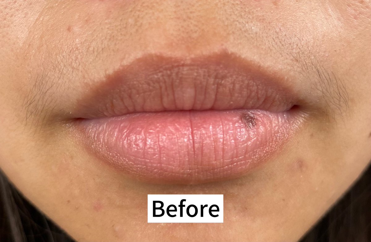 flweryull's tweet photo. Say bye-bye to bibir kering &amp; pecah-pecah!👋

Jujur aku tuh salah satu yg sering struggle dengan masalah bibirku yang mudah kering &amp; pecah-pecah, jadi salah satu cara untuk bantu bibir aku jadi sehat dengan pakai produk lip treatment ini! 

Sangat membantu pokoknya!🫶🥹
— https://t.co/W4CiZgZ6La