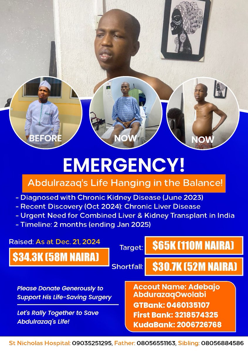 IamAdebajo's tweet image. DONATION UPDATE 21/12/2024

*Amount raised in Naira - 58M*
*Shortfall in Naira - 52M*
*Target in Naira - 110M*
_______

Abdulrazaq is in dire need of our support! He requires a liver and kidney transplant in India. He has both Liver and Kidney donors. Money is the only constraint