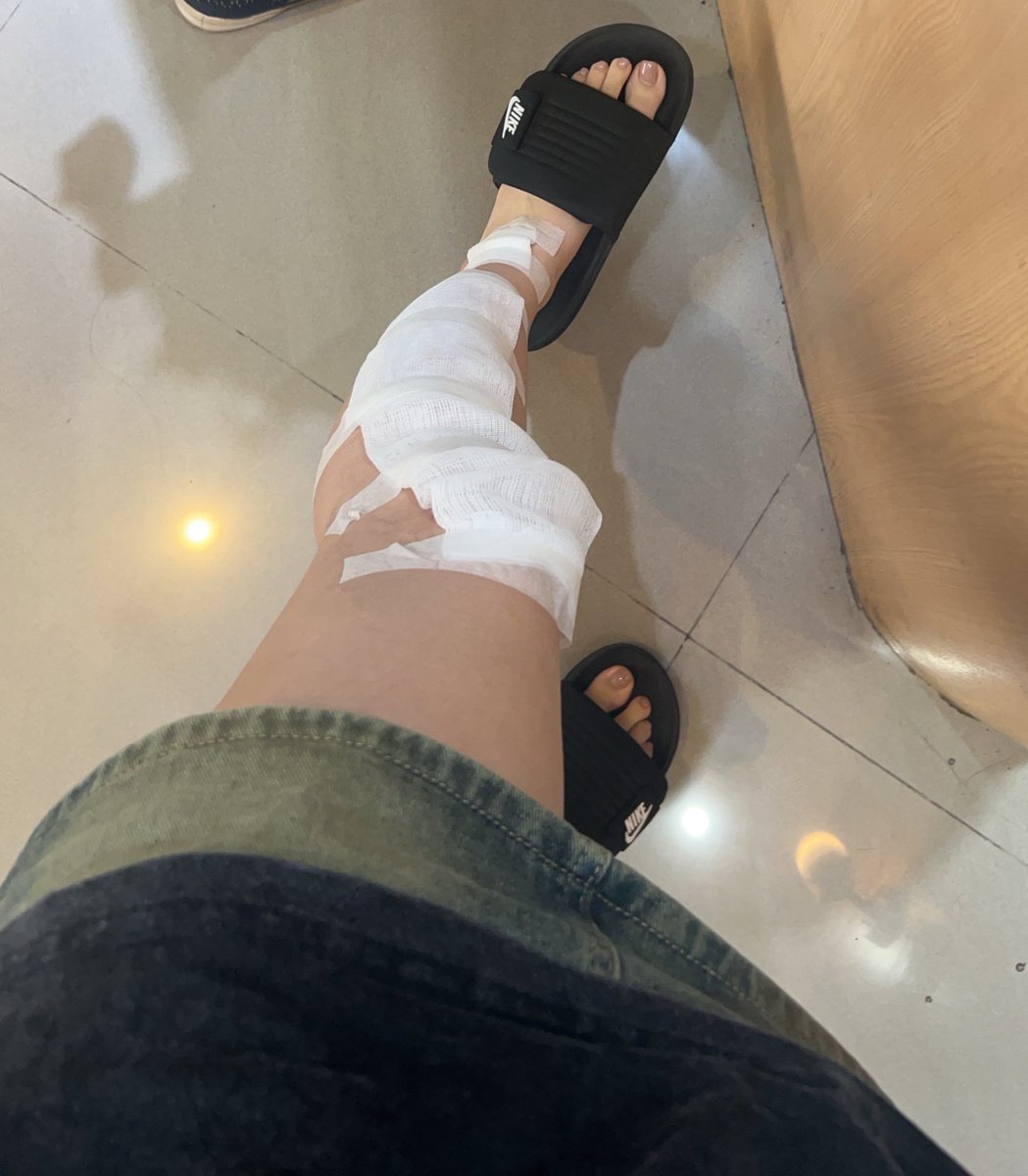 08的腿⋯真的有夠雖