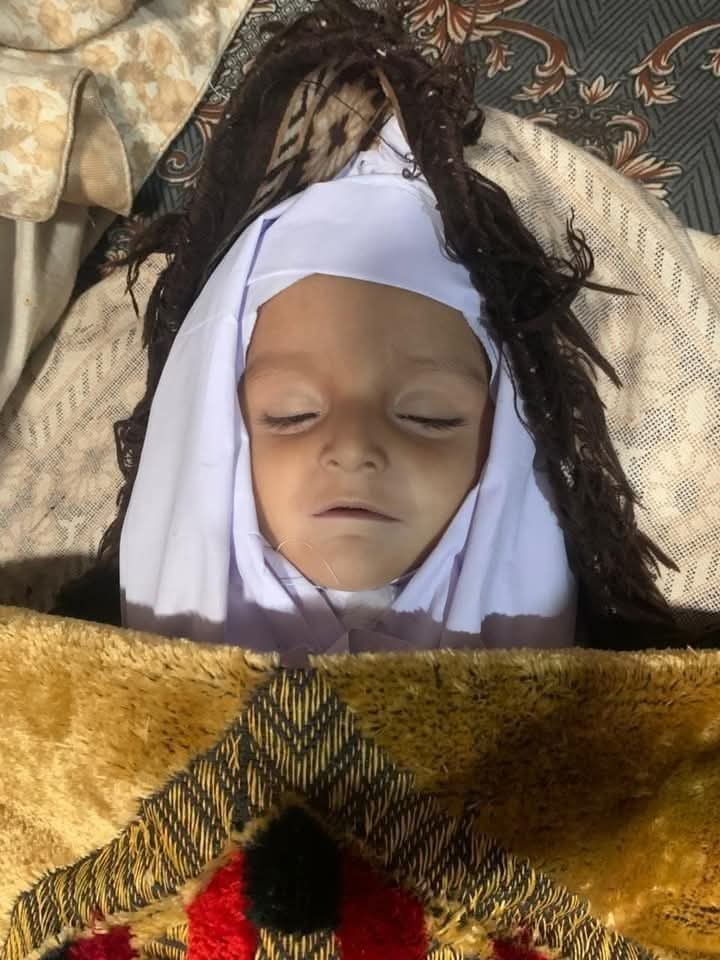 sibtekz's tweet photo. With every passing day, these little flowers died due to shortage of food and medicine. Today marked 75th day of Siege that the people of Parachinar have bearded while state is completely silent.
#PutParachinarOutOfTrouble https://t.co/3f0dYkRUhV