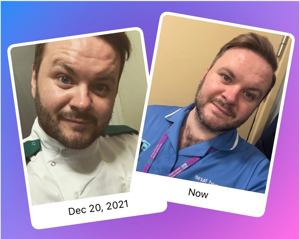 Glenn McDowell (He/Him)๐ณ๏ธโ๐ (@glennmcdowellrn) on Twitter photo 2021 - 2024
๐โก๏ธ๐โก๏ธโค๏ธโก๏ธ๐
In the blink of an eye
#studentnurse #nurse #newlyregistered #emergencycare <a href="/QUBelfast/">Queen's University Belfast ๐</a>
<a href="/QUBSONM/">QUBNursing&Midwifery</a> <a href="/BelfastTrust/">Belfast Trust</a> <a href="/RCNNRN/">RCN Newly Registered Nurses</a> 2021 - 2024
๐โก๏ธ๐โก๏ธโค๏ธโก๏ธ๐
In the blink of an eye
#studentnurse #nurse #newlyregistered #emergencycare <a href="/QUBelfast/">Queen's University Belfast ๐</a>
<a href="/QUBSONM/">QUBNursing&Midwifery</a> <a href="/BelfastTrust/">Belfast Trust</a> <a href="/RCNNRN/">RCN Newly Registered Nurses</a>