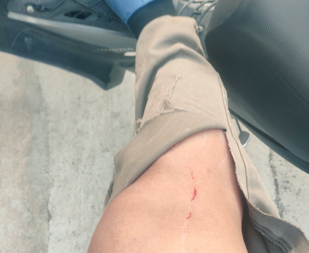 ALONE6690's tweet photo. ขาเราแหกไม่เท่าไหร่  แต่ถ้าได้แหกขาเทอ อ่าเป็นเรื่อง🤣🤣🤣
#พัทยา #สัตหีบ #บ้านฉาง https://t.co/oj8D428qFB