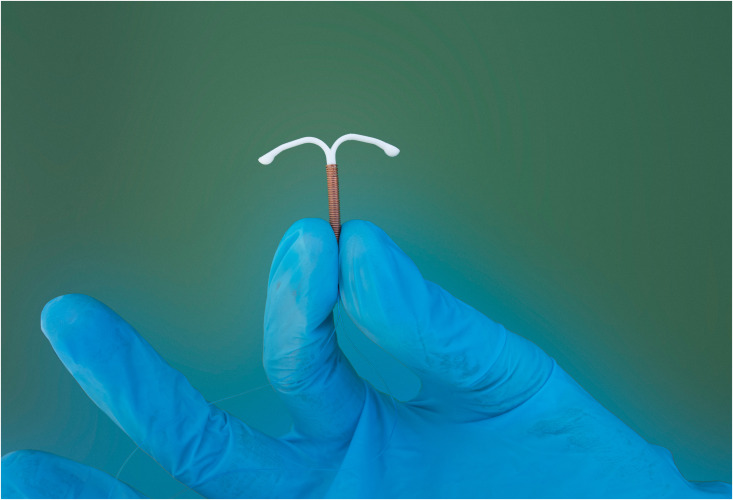 Current evidence supports the safety and efficacy of the extended duration of IUD use among women.

Read more at: nwhjournal.org/article/S1751-…

#NWH #AWHONN