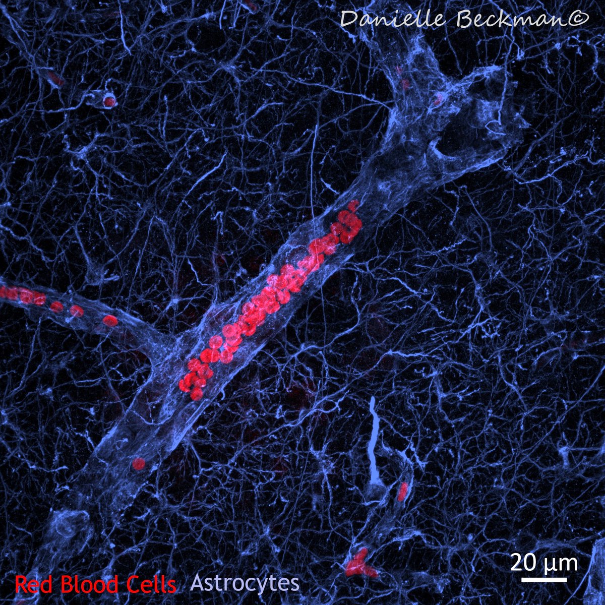 Danielle Beckman tweet media