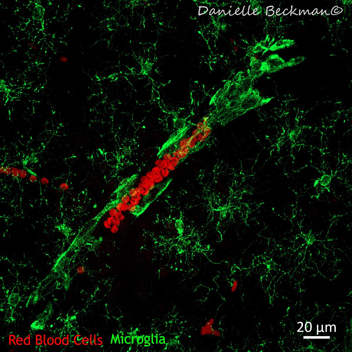 Danielle Beckman tweet media